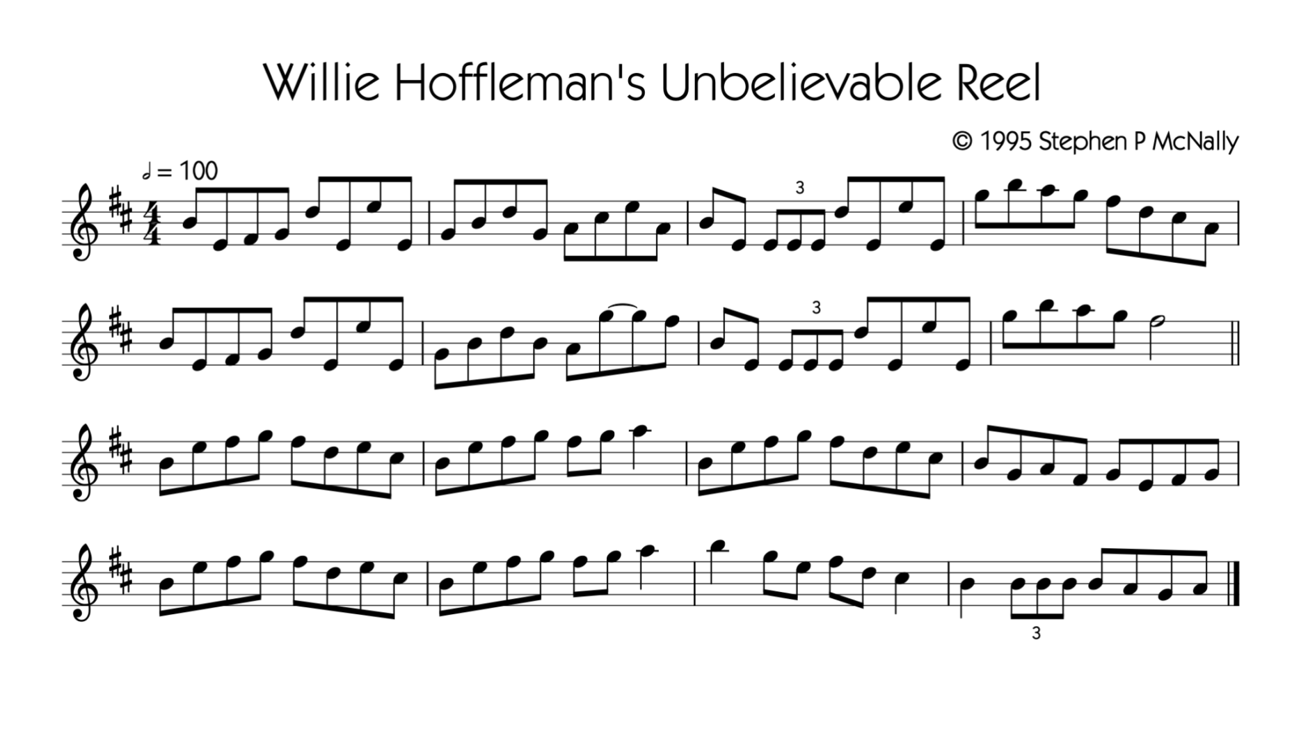 Willie Hoffleman’s Unbelievable Reel